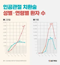 힘찬병원, 여성은 '무릎' 남성은 '고관절' 중년부터 관리해야