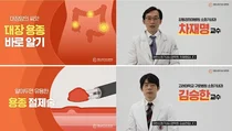 대장암 예방을 위한 용종 바로 알기