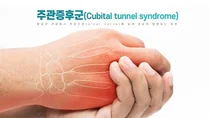 날개병원, 팔꿈치 긴 시간 구부리고 있으면 '주관증후군' 발생 위험