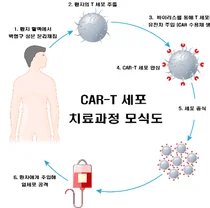 소아백혈병 CAR-T 치료제, 국내 최초 생산 