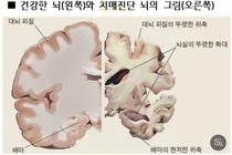 제약사, 콜린 급여중지 취소소송 모두 패소