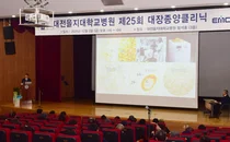 대전을지대병원, 제25회 대장종양클리닉 개최