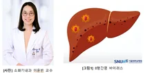 ‘우리 몸 속 조용한 침입자’ B형 간염