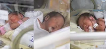 대안산병원 온정으로 외국 국적 세쌍둥이 순산 