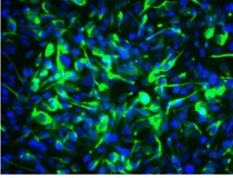 세계 100조 시장 