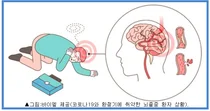 [아스피린프로텍트] 10월 29일, 세계 뇌졸중의 날...예방정보 제공