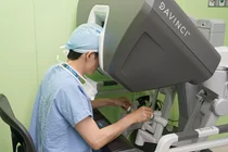 양산부산대병원 정재훈 교수, 비수도권 최초 로봇위암 수술 개인 100례달성