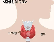 저위험 갑상선 협부암 환자, 협부절제술도 안전하고 효과적