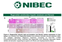 나이벡, 펩타이드 신약 ‘리제노타이드’로 체중은 줄이고 근육은 늘렸다