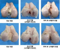 강스템바이오텍, 골관절염 치료제 임상 1/2a상 IND 승인
