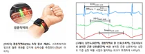 잡음 광용적맥파 심박수로 '高정확' AI제시