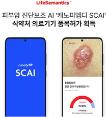 피부암 진단 보조 AI솔루션 ‘캐노피엠디 SCAI’ 허가 획득