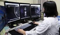 경상국립대병원, AI 활용한 유방암 조기 진단 소프트웨어 도입