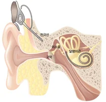 서울대병원, ‘2026 인공와우 토털케어 네트워크’ 성료