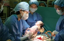 서울아산병원, 고위험 산모·태아 생명 지키며 ‘월 분만 300건’ 달성