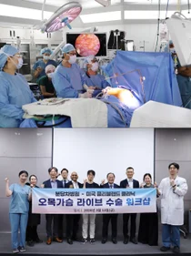 분당차병원·클리블랜드클리닉, '오목가슴 라이브 수술' 워크숍 성료