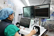 서울아산병원, ‘피지컬 AI’ 국산 1호 심혈관 중재술 로봇 본격 임상 투입