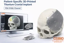 시지바이오 ‘이지메이드 TI’ FDA 510k 허가 받아