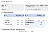 치매 유발 물질 축적 여부, PET 촬영하고 AI로 분석한다