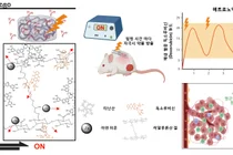 전기 자극으로 항암제 방출 정밀 조절하는 지능형 하이드로겔 개발