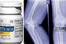 일양약품, 류마티스 치료제 ‘엘란즈정’ 출시