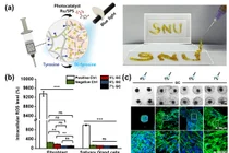  난치성 ‘구강건조증’ 근본적으로 치료하는 융합 시스템 개발