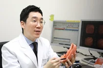 위암 수술 후 재발은 언제 가장 많을까? 위암 재발 예방법은?