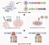 희귀질환 크라베병, 유전자 편집으로 치료