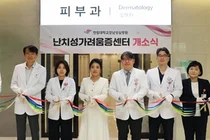 6주 넘는 원인 모를 가려움, 전신질환 위험 높아 조기 다학제협진 필요