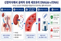 신장이식 후 불필요한 조직검사 줄인다, 거부반응 정밀 선별 입증