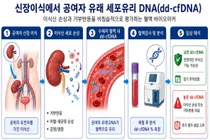 신장이식 후 불필요한 조직검사 줄인다, 거부반응 정밀 선별 입증