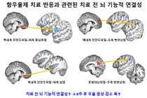 청소년 우울증 항우울제 치료 반응, 치료 전 ‘뇌 기능적 연결성’ 예측