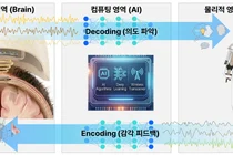 서울대병원, ‘양방향 Brain-to-Robot’ 뇌 칩 이식 임상 총괄