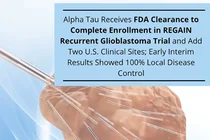 알파타우, 미국 FDA 추가 승인받아 악성 뇌종양 美 임상 확대