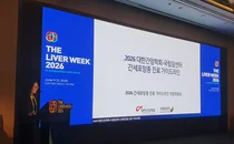 국립암센터·대한간암학회, 간암 진료 새 기준 제시