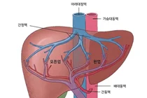 문맥종양혈전 동반 간암 환자, 방사선색전술 효과·안전성 확인