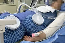 한림화상재단·더멀매트릭스, 화상환자 위한 동행 8년째