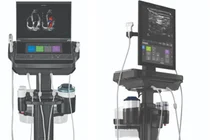 JW메디칼, 프리미엄 현장진단 초음파기기 ‘소노사이트 PX·ST’ 2종 출시