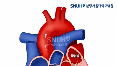 분당서울대병원 순환기내과 황인창·박지석 교수 연구팀