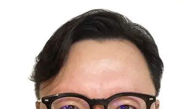고려대학교 안암병원 윤승주 교수, 캄보디아 왕립 모니사라폰 훈장 수훈