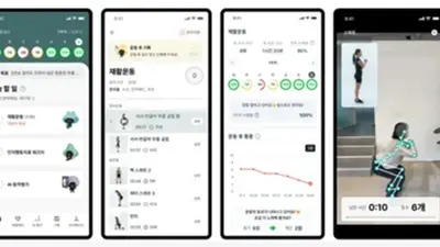 분당차병원 정형외과 박재영 교수팀 영어논문