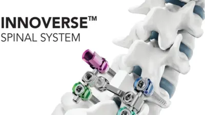 시지메드텍 ‘INNOVERSE Spinal System’, 콜롬비아 INVIMA 허가