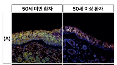 코로 두개저종양 수술 시 ‘후각 저하’, 나이 따라 다르다