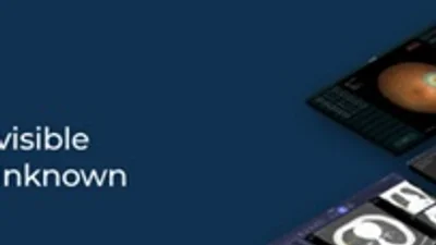 소아중환자 ‘인공호흡기 삽관’ 예측 AI 개발, AUROC 0.88 달성