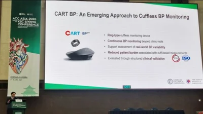 반지형 혈압계 ‘카트 비피 프로’, 글로벌 권고-임상 가치 재확인