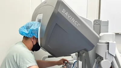 세계 최초, 비만 환자 대상 ‘지능형 스테이플러’ 결합 단일공 로봇수술 성공