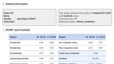 치매 유발 물질 축적 여부, PET 촬영하고 AI로 분석한다