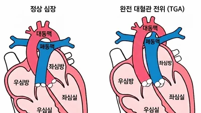 서울대병원-전남대병원, 완전 대혈관 전위 수술 후 장기 안정성 확인