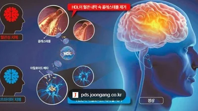 콜린, 첫 임상재평가…목표 미충족에도 '인지' 개선 확인