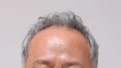 서울시醫, 